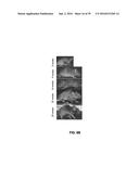 COMPOUNDS FOR THE TREATMENT OF PATHOLOGIES ASSOCIATED WITH AGING AND     DEGENERATIVE DISORDERS diagram and image