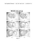 N,N -DI-1 NAPHTHYLGUANIDINE HCL (NAGH) AND N,N -DI-P-NITROPHENYLGUANIDINE     HCL (NAD) TREATMENT FOR STROKE AT DELAYED TIMEPOINTS diagram and image