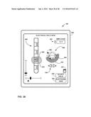 UNWRAPPED 2D VIEW OF A STIMULATION LEAD WITH COMPLEX ELECTRODE ARRAY     GEOMETRY diagram and image