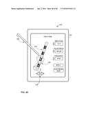 UNWRAPPED 2D VIEW OF A STIMULATION LEAD WITH COMPLEX ELECTRODE ARRAY     GEOMETRY diagram and image