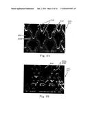 Apparatus for Making Polymeric Web Exhibiting a Soft and Silky Tactile     Impression diagram and image