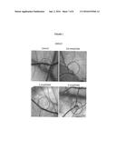 TRICYCLIC PYRROLE COMPOUNDS, THEIR PREPARATION AND USE IN MEDICAMENTS diagram and image