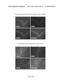 DELIVERY, ENGINEERING AND OPTIMIZATION OF SYSTEMS, METHODS AND     COMPOSITIONS FOR TARGETING AND MODELING DISEASES AND DISORDERS OF POST     MITOTIC CELLS diagram and image