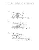 GAS TURBINE ENGINE COMPONENT WITH CONVERGING/DIVERGING COOLING PASSAGE diagram and image