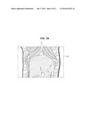 MEDICAL IMAGE PROCESSING APPARATUS AND MEDICAL IMAGE REGISTRATION METHOD     USING THE SAME diagram and image