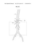 MEDICAL IMAGE PROCESSING APPARATUS AND MEDICAL IMAGE REGISTRATION METHOD     USING THE SAME diagram and image