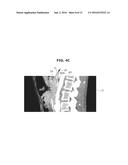 MEDICAL IMAGE PROCESSING APPARATUS AND MEDICAL IMAGE REGISTRATION METHOD     USING THE SAME diagram and image