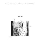 MEDICAL IMAGE PROCESSING APPARATUS AND MEDICAL IMAGE REGISTRATION METHOD     USING THE SAME diagram and image