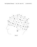 Hearing-Aid Noise Reduction Circuitry With Neural Feedback To Improve     Speech Comprehension diagram and image