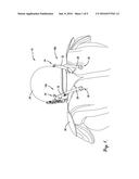 DEVICE TO REDUCE TRAUMATIC BRAIN INJURY diagram and image