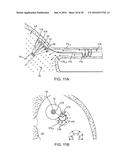 Systems And Methods For Unobstructed Visualization And Ablation diagram and image