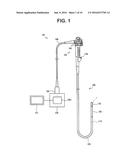 ENDOSCOPE diagram and image