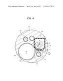 ENDOSCOPE diagram and image