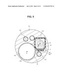 ENDOSCOPE diagram and image