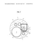 ENDOSCOPE diagram and image