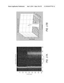 MR SPECTROSCOPY SYSTEM AND METHOD FOR DIAGNOSING PAINFUL AND NON-PAINFUL     INTERVERTEBRAL DISCS diagram and image