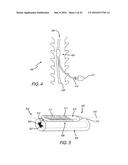 SPINAL CORD STIMULATION GUIDANCE SYSTEM AND METHOD OF USE diagram and image