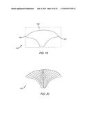 SPINAL CORD STIMULATION GUIDANCE SYSTEM AND METHOD OF USE diagram and image