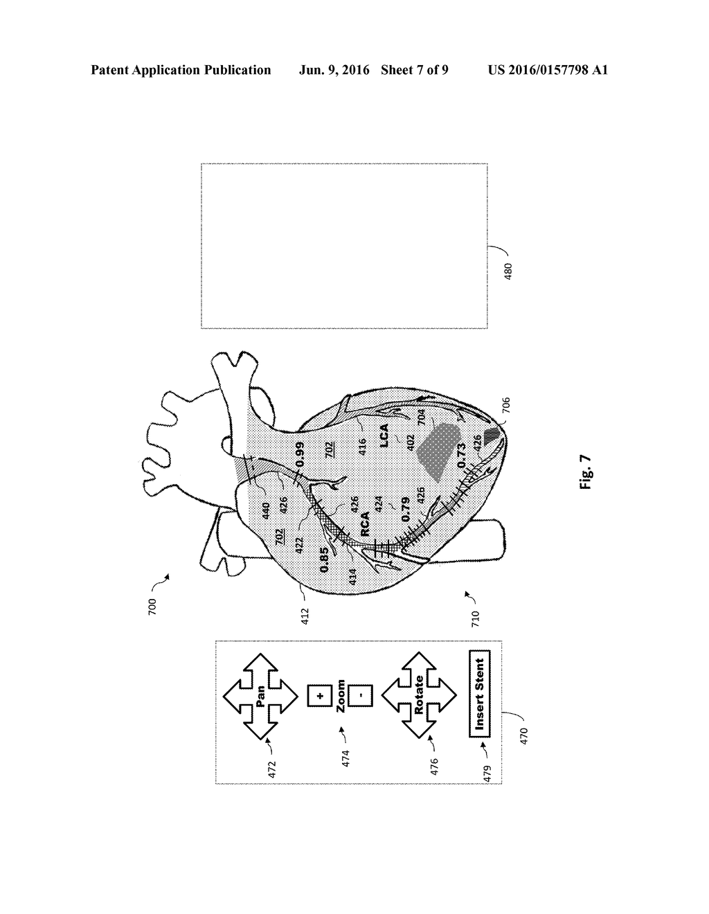 INTERACTIVE CARDIAC TEST DATA AND ASSOCIATED DEVICES, SYSTEMS, AND METHODS - diagram, schematic, and image 08