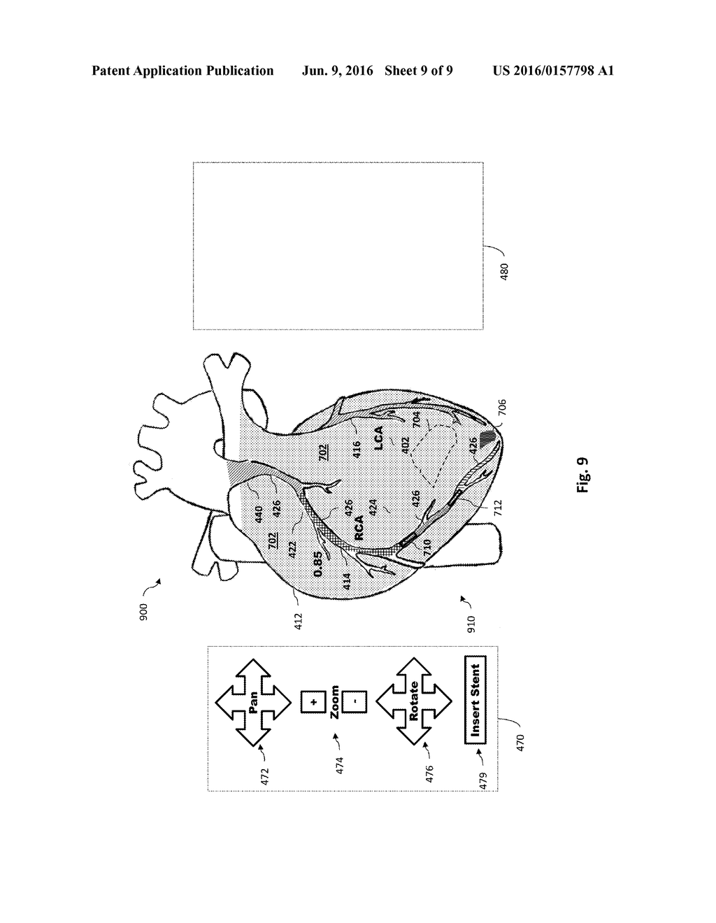 INTERACTIVE CARDIAC TEST DATA AND ASSOCIATED DEVICES, SYSTEMS, AND METHODS - diagram, schematic, and image 10