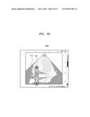 ULTRASOUND METHOD AND APPARATUS FOR PROCESSING ULTRASOUND IMAGE diagram and image