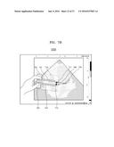 ULTRASOUND METHOD AND APPARATUS FOR PROCESSING ULTRASOUND IMAGE diagram and image