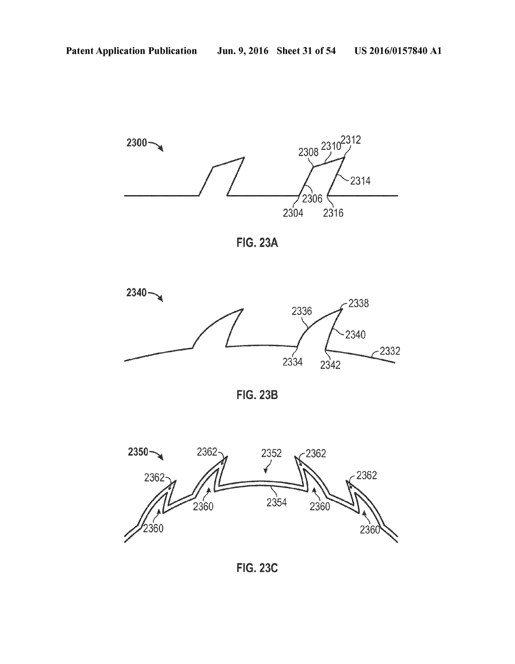 FISTULA TREATMENT DEVICES AND RELATED METHODS - diagram, schematic, and image 32