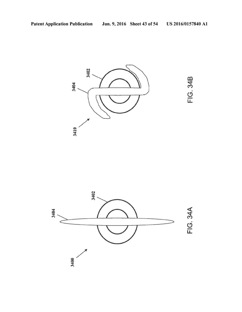 FISTULA TREATMENT DEVICES AND RELATED METHODS - diagram, schematic, and image 44