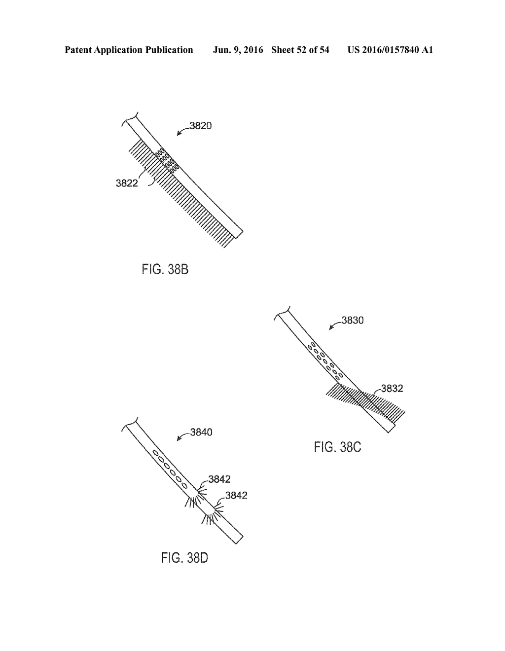 FISTULA TREATMENT DEVICES AND RELATED METHODS - diagram, schematic, and image 53