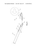 METHOD OF FIXATING AN IMPLANTABLE MATERIAL IN A PATIENT diagram and image