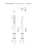 METHOD OF FIXATING AN IMPLANTABLE MATERIAL IN A PATIENT diagram and image