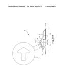 METHOD OF FIXATING AN IMPLANTABLE MATERIAL IN A PATIENT diagram and image