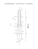 METHOD OF FIXATING AN IMPLANTABLE MATERIAL IN A PATIENT diagram and image