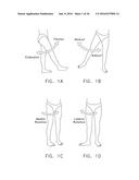 METHOD AND APPARATUS FOR RE-ATTACHING THE LABRUM TO THE ACETABULUM     INCLUDING THE PROVISION AND USE OF A NOVEL SUTURE ANCHOR SYSTEM diagram and image