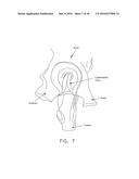 METHOD AND APPARATUS FOR RE-ATTACHING THE LABRUM TO THE ACETABULUM     INCLUDING THE PROVISION AND USE OF A NOVEL SUTURE ANCHOR SYSTEM diagram and image