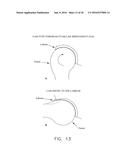 METHOD AND APPARATUS FOR RE-ATTACHING THE LABRUM TO THE ACETABULUM     INCLUDING THE PROVISION AND USE OF A NOVEL SUTURE ANCHOR SYSTEM diagram and image