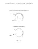 METHOD AND APPARATUS FOR RE-ATTACHING THE LABRUM TO THE ACETABULUM     INCLUDING THE PROVISION AND USE OF A NOVEL SUTURE ANCHOR SYSTEM diagram and image