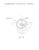 METHOD AND APPARATUS FOR RE-ATTACHING THE LABRUM TO THE ACETABULUM     INCLUDING THE PROVISION AND USE OF A NOVEL SUTURE ANCHOR SYSTEM diagram and image