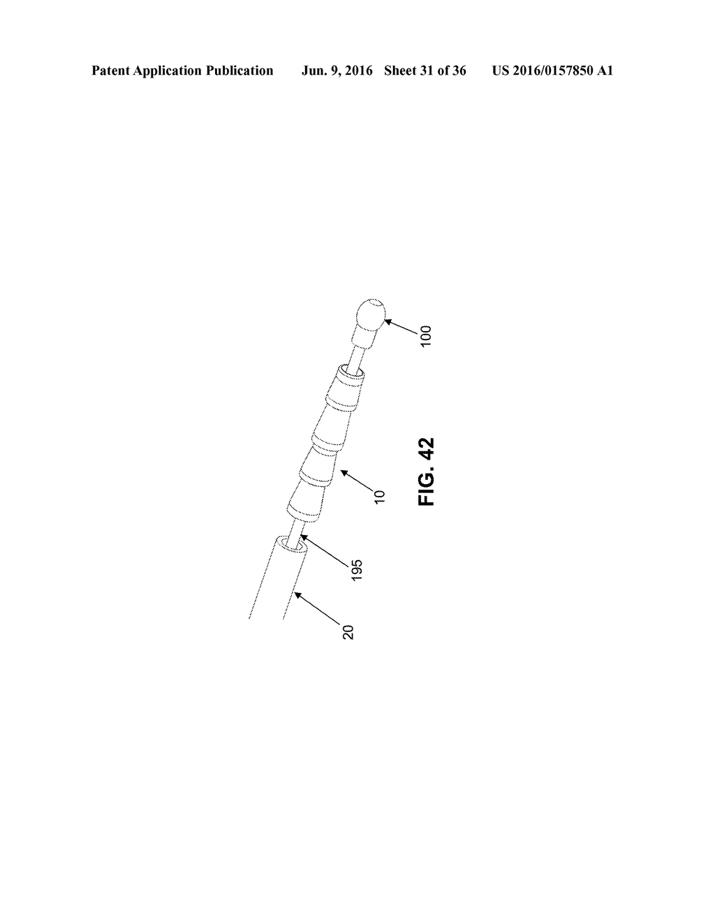 METHOD AND APPARATUS FOR RE-ATTACHING THE LABRUM TO THE ACETABULUM     INCLUDING THE PROVISION AND USE OF A NOVEL SUTURE ANCHOR SYSTEM - diagram, schematic, and image 32
