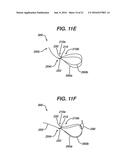 IMPLANT HAVING ADJUSTABLE FILAMENT COILS diagram and image