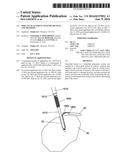 IMPLANT PLACEMENT SYSTEMS, DEVICES AND METHODS diagram and image