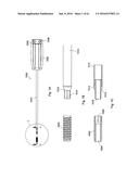 IMPLANT PLACEMENT SYSTEMS, DEVICES AND METHODS diagram and image