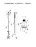 IMPLANT PLACEMENT SYSTEMS, DEVICES AND METHODS diagram and image