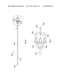 IMPLANT PLACEMENT SYSTEMS, DEVICES AND METHODS diagram and image