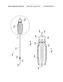 IMPLANT PLACEMENT SYSTEMS, DEVICES AND METHODS diagram and image