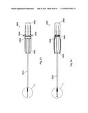 IMPLANT PLACEMENT SYSTEMS, DEVICES AND METHODS diagram and image