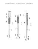 IMPLANT PLACEMENT SYSTEMS, DEVICES AND METHODS diagram and image