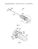 IMPLANT PLACEMENT SYSTEMS, DEVICES AND METHODS diagram and image