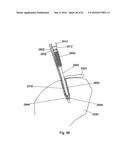 IMPLANT PLACEMENT SYSTEMS, DEVICES AND METHODS diagram and image