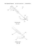 IMPLANT PLACEMENT SYSTEMS, DEVICES AND METHODS diagram and image